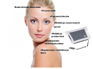 Konkurs "MIKRODERMABRAZJA idealna jesienią" Wrocław, do godz. 20:00