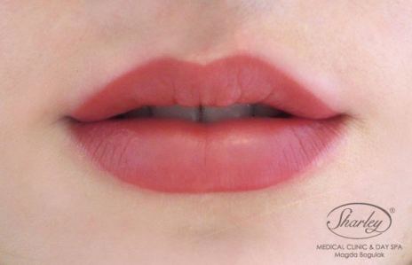 Konkurs "Metamorfoza uśmiechu"