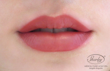 Konkurs "Metamorfoza uśmiechu"