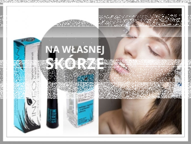 Konkurs "Hypoalergiczne Serum INVEO do rzęs"
