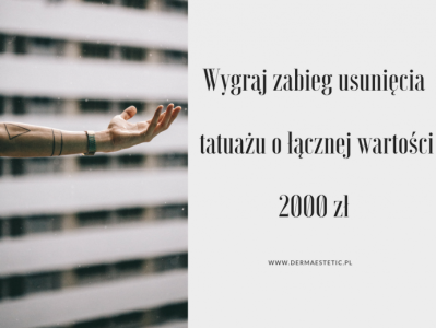 Wygraj zabieg usunięcia tatuażu o wartości 2 000 zł!