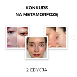 Konkurs na metamorfozę od Veoli Botanica