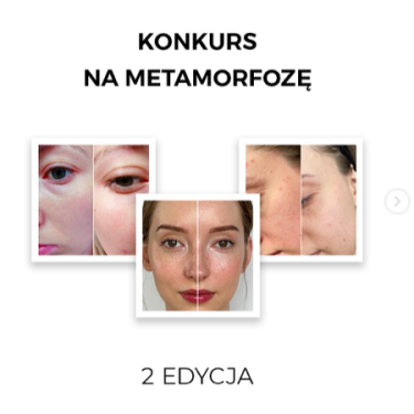 Konkurs na metamorfozę od Veoli Botanica
